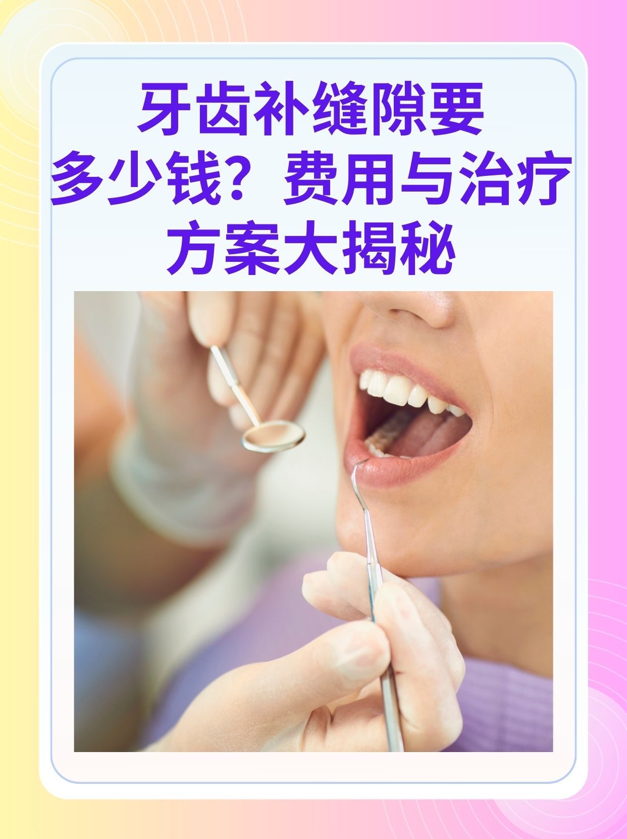 徐州补牙医保可以报销吗(补牙医保可以报销吗 哪些可以报销呢)